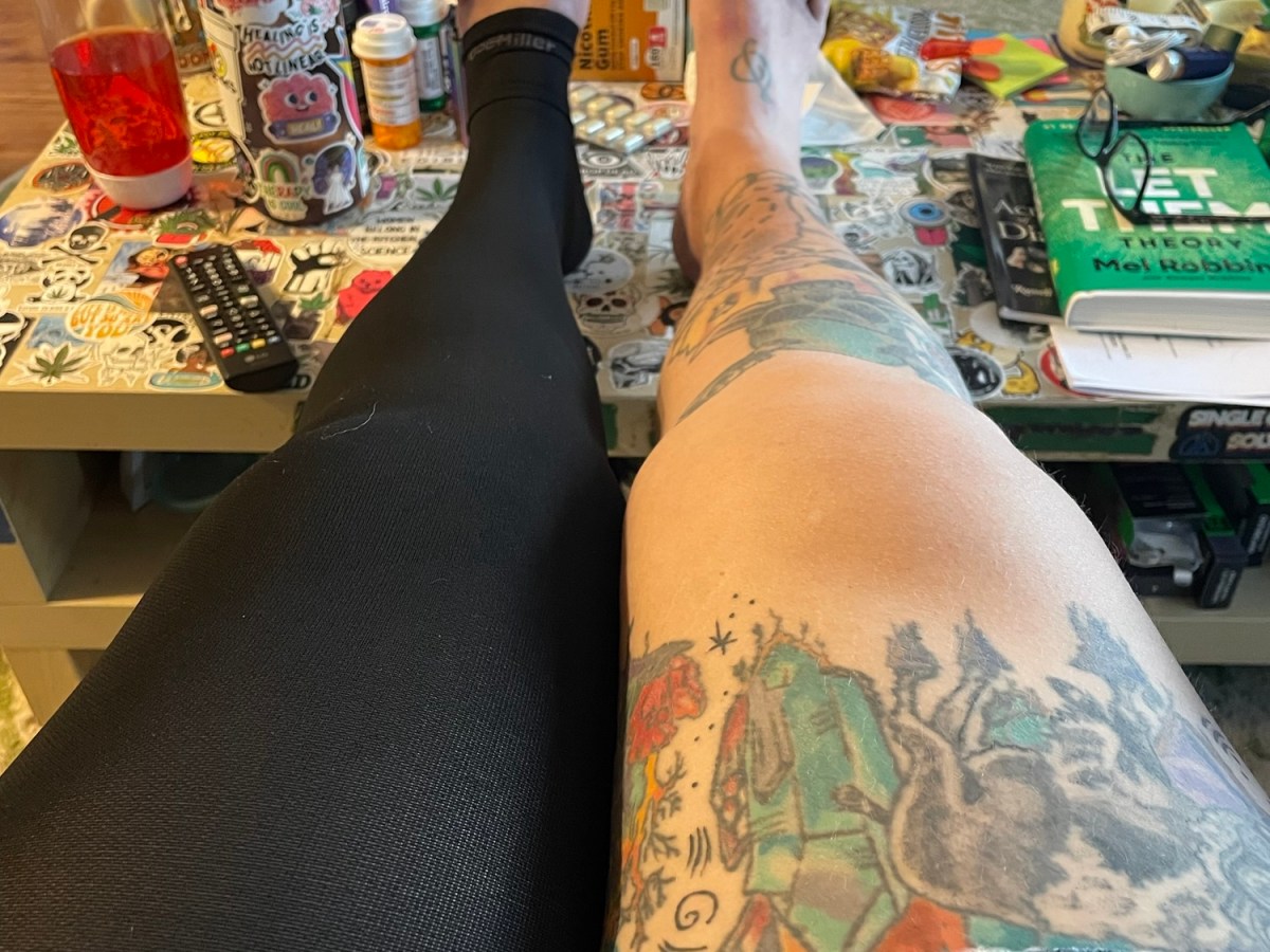 The First Vein&nbsp;Ablation